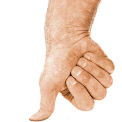 Under%20the%20thumb.jpg